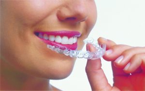 A woman with bright pink lipstick holding an Invisalign aligner in front of her mouth